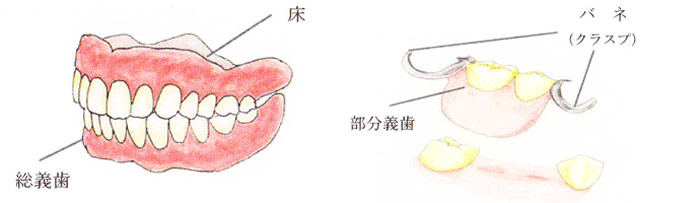 義歯