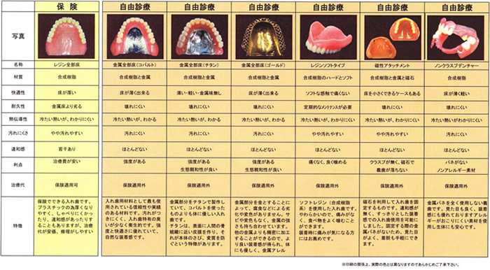 入れ歯の種類