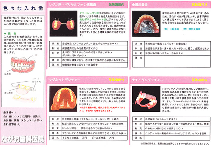 入れ歯の種類